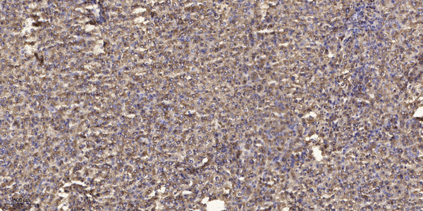 Anti-MUC6 antibody (960-1040) (STJA0010110) – Figure 1 of 1