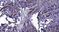 Anti-PPP3CA antibody (STJA0010127) – Figure 1 of 1