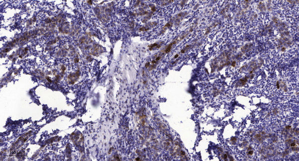 Anti-PPP3CA antibody (STJA0010127) – Figure 1 of 1