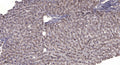 Anti-MUSK antibody (STJA0010128) – Figure 1 of 1