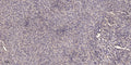 Anti-NRIP1 antibody (STJA0010137) – Figure 1 of 1