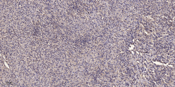Anti-NRIP1 antibody (STJA0010137) – Figure 1 of 1