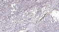 Anti-PDCD1 antibody (80-130) (STJA0010139) – Figure 1 of 1
