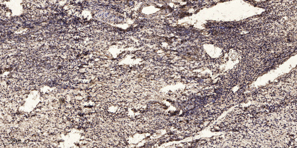 Anti-CXCL11 antibody (45-94) (STJA0010150) – Figure 1 of 1