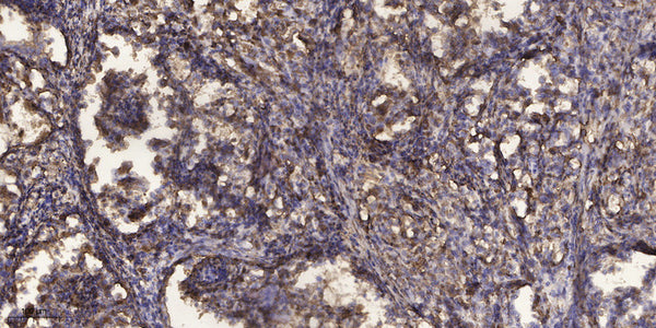 Anti-PROZ antibody (141-190) (STJA0010168) – Figure 1 of 1