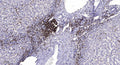 Anti-MSLN antibody (STJA0010203) – Figure 1 of 1