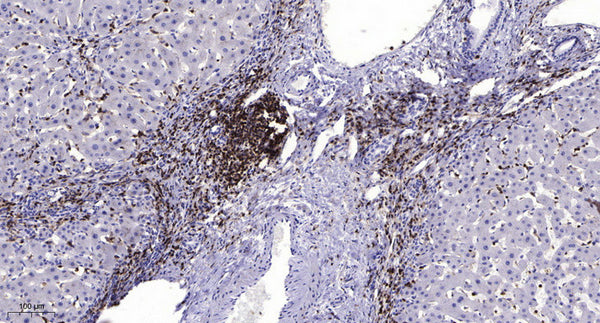 Anti-MSLN antibody (STJA0010203) – Figure 1 of 1