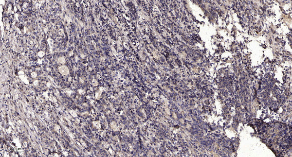 Anti-OPN1SW antibody (STJA0010212) – Figure 1 of 1