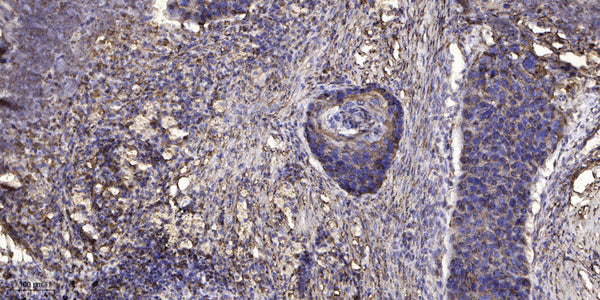 Anti-MAP1LC3A antibody (STJA0010241) – Figure 1 of 1