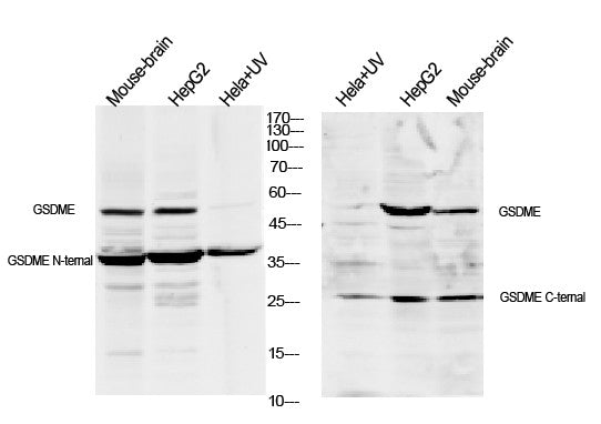 Anti-GSDME antibody (400-496) (STJA0010251) – Figure 1 of 1