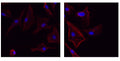 Anti-GSDME antibody (1-100) (STJA0010252) – Figure 1 of 1