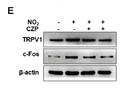Anti-TRPV1 antibody (STJA0010256) – Figure 1 of 1