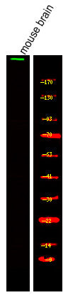 Anti-USP34 antibody (STJA0010292) – Figure 1 of 1