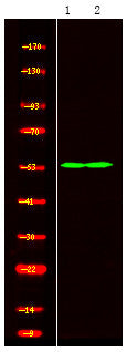 Anti-SMARCD1 antibody (STJA0010293) – Figure 1 of 1