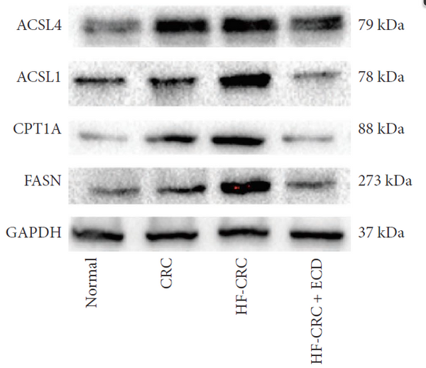 Anti-ACSL4 antibody (STJA0010306) – Figure 1 of 1