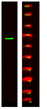 Anti-METTL3 antibody (N-Term) (STJA0010338) – Figure 1 of 1