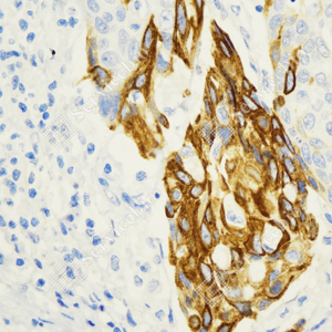 Anti-Recombinant-Cytokeratin 16/K16 antibody [SM8242] (STJA0018242) – Figure 1 of 1
