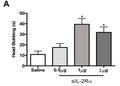 Human IL2RA (CD25) protein (Recombinant) (STJP000332) – Figure 1 of 1