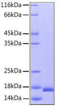Human IL-36Ra/IL-1F5 protein (Recombinant) (C-His) (STJP000805) – Figure 1 of 1