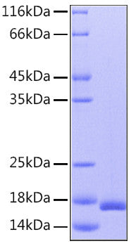 Human IL-36Ra/IL-1F5 protein (Recombinant) (C-His) (STJP000805) – Figure 1 of 1