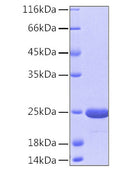 Human DJ-1/PARK7 protein (Recombinant) (No tag) (STJP000817) – Figure 1 of 1
