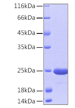 Human DJ-1/PARK7 protein (Recombinant) (No tag) (STJP000817) – Figure 1 of 1