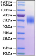 Human MIC-A protein (Recombinant) (C-His) (STJP000947) – Figure 1 of 1