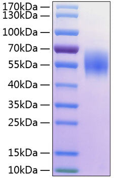 Human MIC-A protein (Recombinant) (C-His) (STJP000947) – Figure 1 of 1