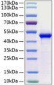Human WIF-1 (Q166K) protein (Recombinant) (C-His) (STJP000963) – Figure 1 of 1