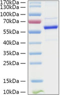 Human TET2 protein (Recombinant) (STJP001330) – Figure 1 of 1