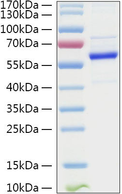 Human TET2 protein (Recombinant) (STJP001330) – Figure 1 of 1