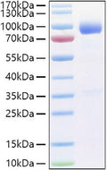 Human IL-1R3/IL-1RAcP/IL1RAP protein (Recombinant) (C-hFc) (STJP001374) – Figure 1 of 1