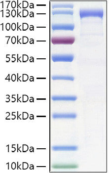 Human CDH6/K-Cadherin protein (Recombinant) (C-hFc&His) (STJP001398) – Figure 1 of 1