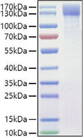 Mouse OSMR/IL-31RB protein (Recombinant) (C-His) (STJP001462) – Figure 1 of 1
