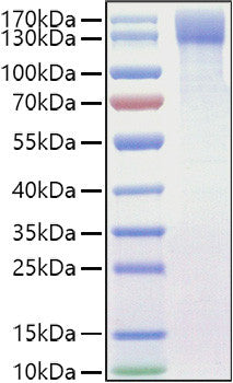 Mouse OSMR/IL-31RB protein (Recombinant) (C-His) (STJP001462) – Figure 1 of 1