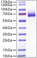 Mouse IL-2-RA/CD25 protein (Recombinant) (C-hFc) (STJP001474) – Figure 1 of 1