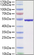 SARS-COV-2 Nucleocapsid (B.1.1.529/Omicron) protein (Recombinant) (C-His) (STJP001478) – Figure 1 of 1