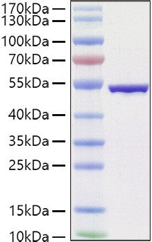 SARS-COV-2 Nucleocapsid (B.1.1.529/Omicron) protein (Recombinant) (C-His) (STJP001478) – Figure 1 of 1