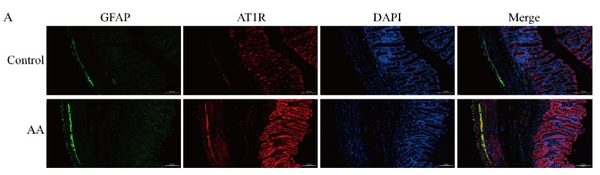 Goat Anti-Mouse IgG Heavy & Light Chain antibody {Alexa Fluor 488} (STJS000301) – Figure 1 of 1
