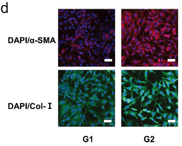 Goat Anti-Rabbit IgG Heavy & Light Chain antibody {Alexa Fluor 488} (STJS000304) – Figure 1 of 1