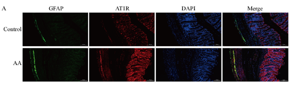 Goat Anti-Mouse IgG Heavy & Light Chain antibody {Alexa Fluor 568} (STJS000430) – Figure 1 of 1