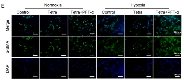 Goat Anti-Rabbit IgG antibody {Dylight 488} (STJS000773) – Figure 1 of 1