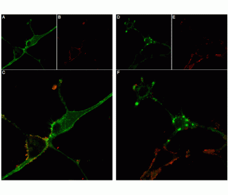 Stichodactyla Toxin-ATTO Fluor-590