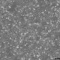 SUM149PT cell