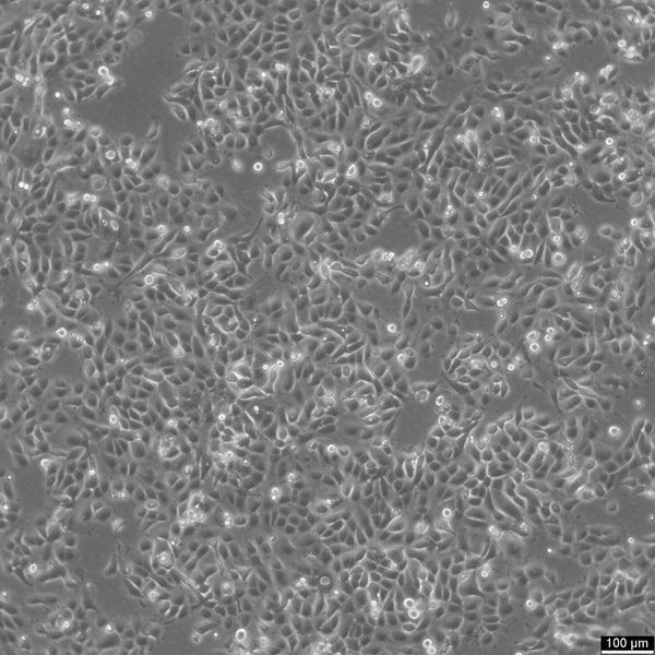 SUM149PT cell