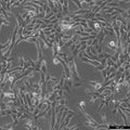 SUM159PT cell