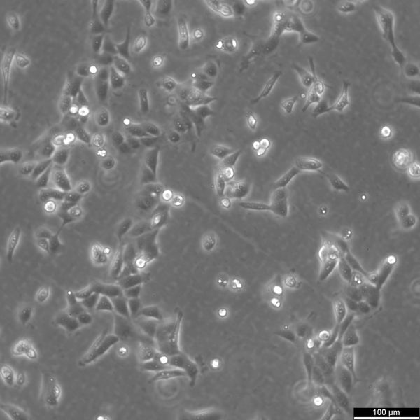 SV-HUC-1 cell