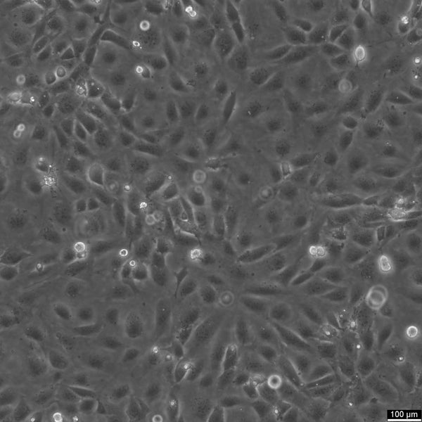 SVEC4-10 cell