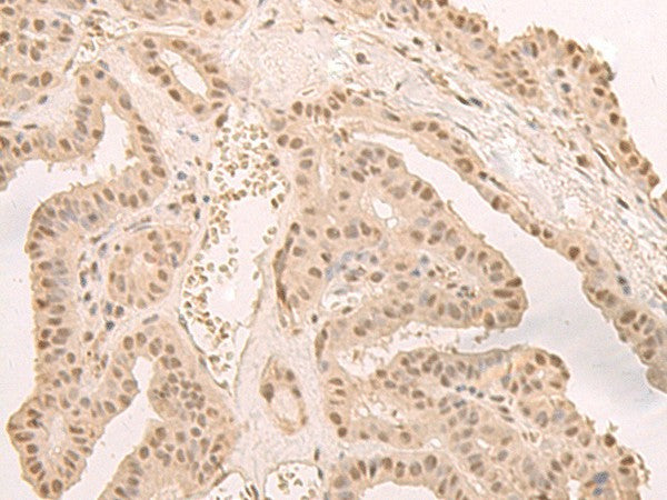 CNOT10 Polyclonal Antibody – Figure 1 of 3