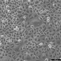 SW-13 cell